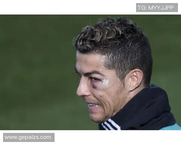 足球明星比赛中眉骨受伤紧急缝针现场直击球迷心痛不已 足球明星比赛中眉骨受伤紧急缝针现场直击球迷心痛不已